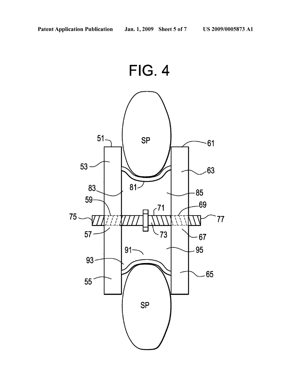 Spinous Process Spacer Hammock - diagram, schematic, and image 06