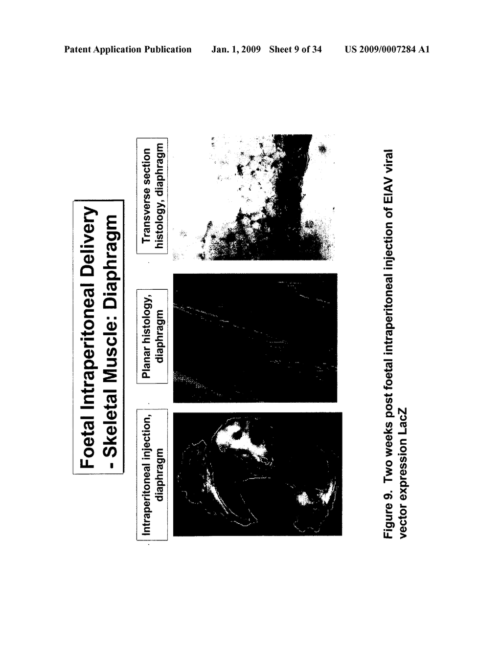 TRANSGENIC ORGANISM - diagram, schematic, and image 10