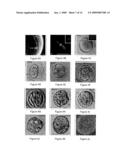 METHODS FOR CORRECTING MITOTIC SPINDLE DEFECTS AND OPTIMIZING PREIMPLANTATION EMBRYONIC DEVELOPMENTAL RATES ASSOCIATED WITH SOMATIC CELL NUCLEAR TRANSFER IN ANIMALS diagram and image