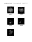 METHODS FOR CORRECTING MITOTIC SPINDLE DEFECTS AND OPTIMIZING PREIMPLANTATION EMBRYONIC DEVELOPMENTAL RATES ASSOCIATED WITH SOMATIC CELL NUCLEAR TRANSFER IN ANIMALS diagram and image