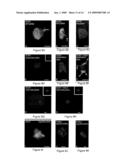 METHODS FOR CORRECTING MITOTIC SPINDLE DEFECTS AND OPTIMIZING PREIMPLANTATION EMBRYONIC DEVELOPMENTAL RATES ASSOCIATED WITH SOMATIC CELL NUCLEAR TRANSFER IN ANIMALS diagram and image