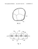 METHOD OF MANUFACTURING DENTAL INSTRUMENTS FROM SUPER-ELASTIC ALLOYS diagram and image