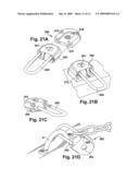 SECURE MOUNTING ARRANGEMENTS FOR A LOCK ASSEMBLY diagram and image