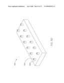 SYSTEM AND METHOD FOR CONTROLLING THE DIAMETER OF A MAMMILIAN HYBRID CORONARY BYPASS GRAFT diagram and image