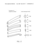 SYSTEM AND METHOD FOR CONTROLLING THE DIAMETER OF A MAMMILIAN HYBRID CORONARY BYPASS GRAFT diagram and image