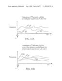 SYSTEM AND METHOD FOR CONTROLLING THE DIAMETER OF A MAMMILIAN HYBRID CORONARY BYPASS GRAFT diagram and image