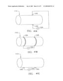 SYSTEM AND METHOD FOR CONTROLLING THE DIAMETER OF A MAMMILIAN HYBRID CORONARY BYPASS GRAFT diagram and image