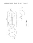 SYSTEM AND METHOD FOR CONTROLLING THE DIAMETER OF A MAMMILIAN HYBRID CORONARY BYPASS GRAFT diagram and image