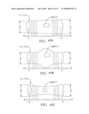 SYSTEM AND METHOD FOR CONTROLLING THE DIAMETER OF A MAMMILIAN HYBRID CORONARY BYPASS GRAFT diagram and image