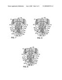 Valve for Allocating Available Fluid To High Priority Functions of a Hydraulic System diagram and image