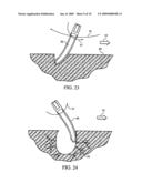 AERATION DEVICE diagram and image