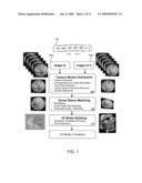 SYSTEM AND METHOD FOR GENERATING A 3D MODEL OF ANATOMICAL STRUCTURE USING A PLURALITY OF 2D IMAGES diagram and image