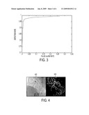 System and method for coronary digital subtraction angiography diagram and image