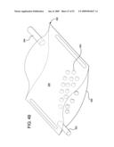 DIALYSIS FLUID HEATING USING PRESSURE AND VACUUM diagram and image