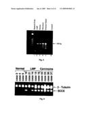 Methods for the early diagnosis of ovarian cancer diagram and image