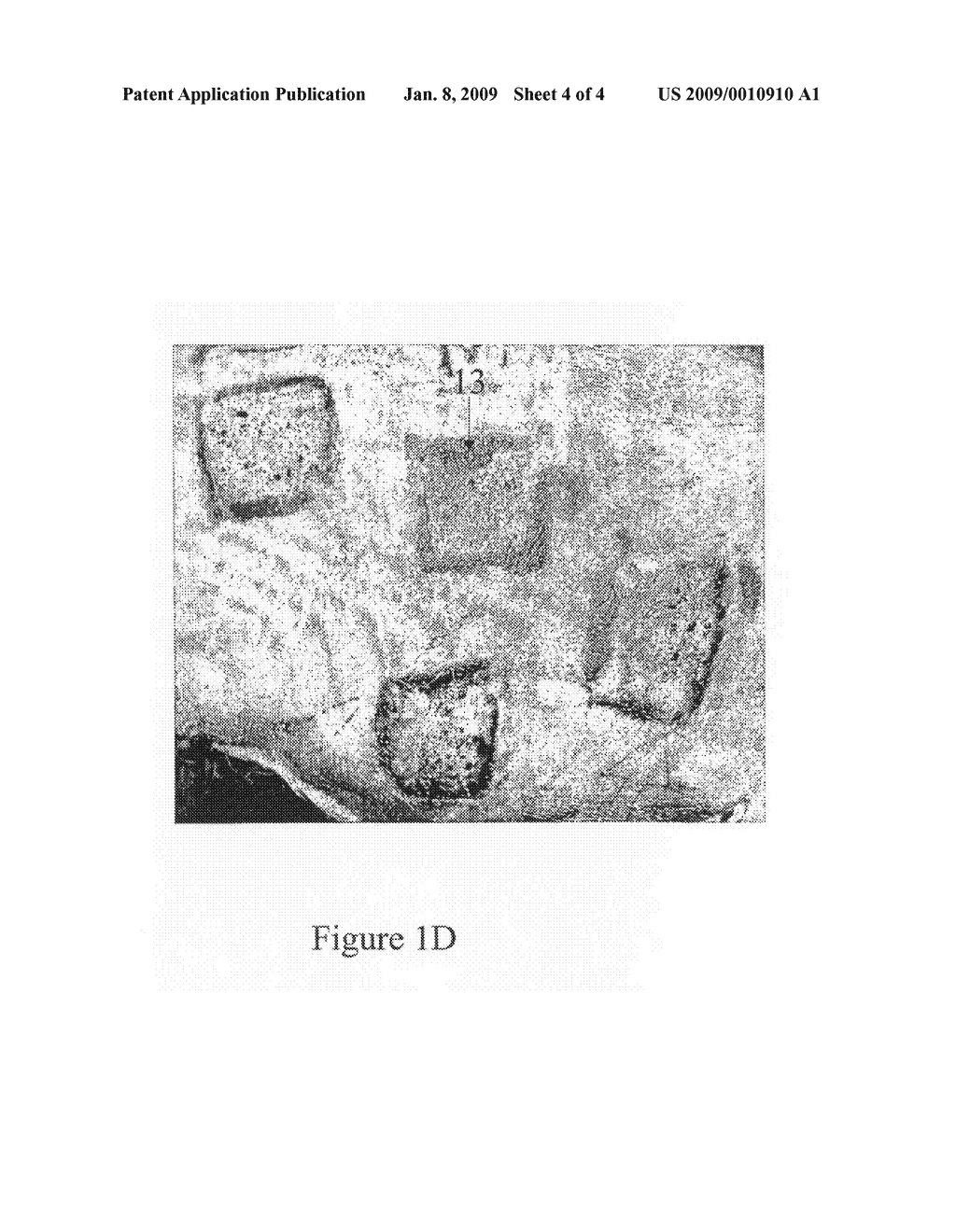 COMPOSITIONS AND METHODS FOR DERMATOLOGICAL WOUND HEALING - diagram, schematic, and image 05