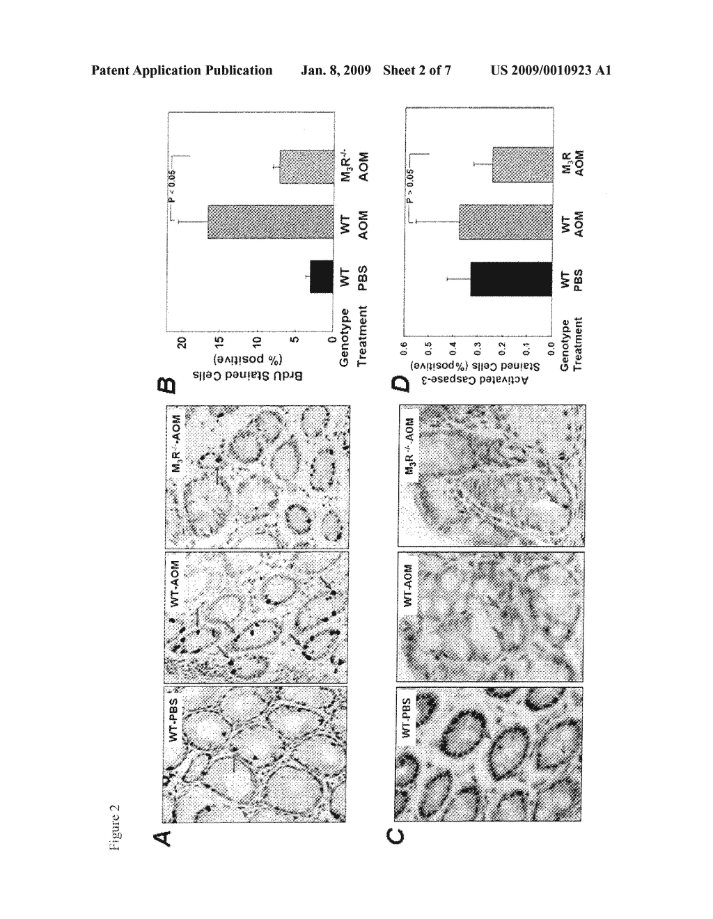 TREATMENT OF CANCER WITH ANTI-MUSCARINIC RECEPTOR AGENTS - diagram, schematic, and image 03