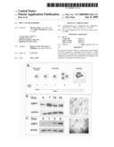 HIP1 cancer markers diagram and image