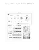 HIP1 cancer markers diagram and image