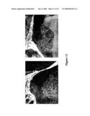 Methods and Compositions Related to TR4 diagram and image