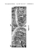 Methods and Compositions Related to TR4 diagram and image