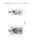 Methods of treating cancer with HDAC inhibitors diagram and image