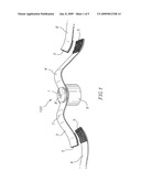 Magnetotherapy diagram and image