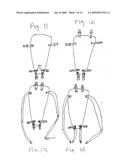 Apparatus for Posterior Pelvic Floor Repair diagram and image