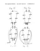 Apparatus for Posterior Pelvic Floor Repair diagram and image