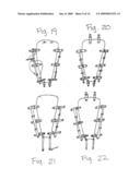 Apparatus for Posterior Pelvic Floor Repair diagram and image