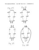 Apparatus for Posterior Pelvic Floor Repair diagram and image