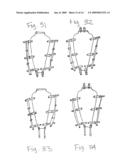 Apparatus for Posterior Pelvic Floor Repair diagram and image