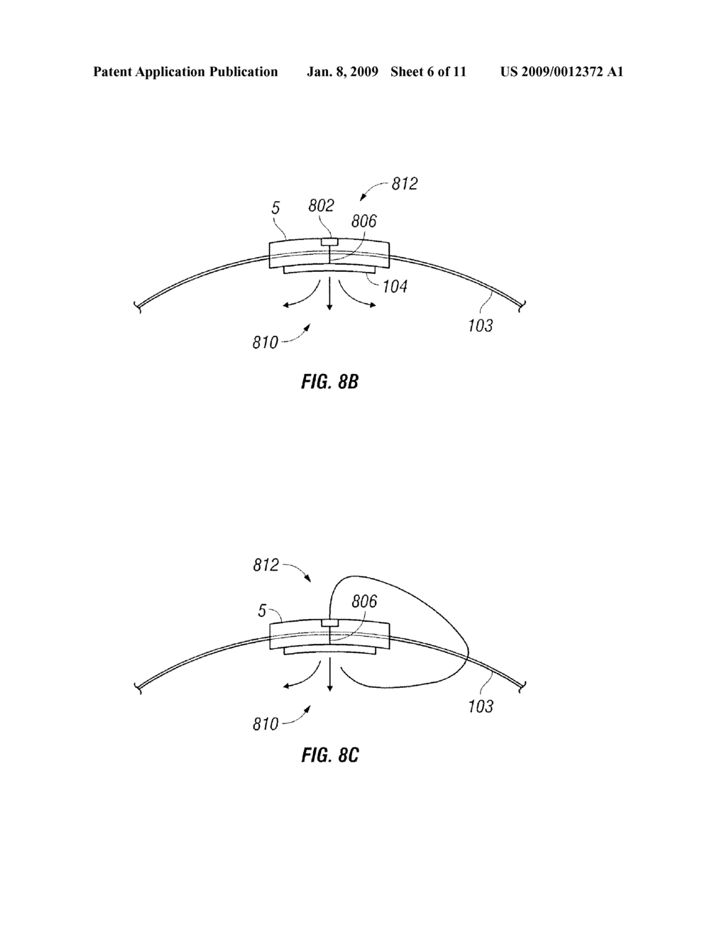 EXTERNAL SENSING FOR IMPLANT RUPTURE - diagram, schematic, and image 07