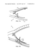 Surgical clamping instruments and methods diagram and image