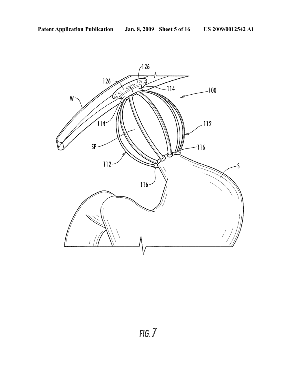 SATIATION DEVICES AND METHODS FOR CONTROLLING OBESITY - diagram, schematic, and image 06