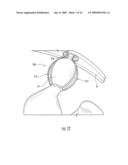 SATIATION DEVICES AND METHODS FOR CONTROLLING OBESITY diagram and image