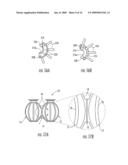 SATIATION DEVICES AND METHODS FOR CONTROLLING OBESITY diagram and image