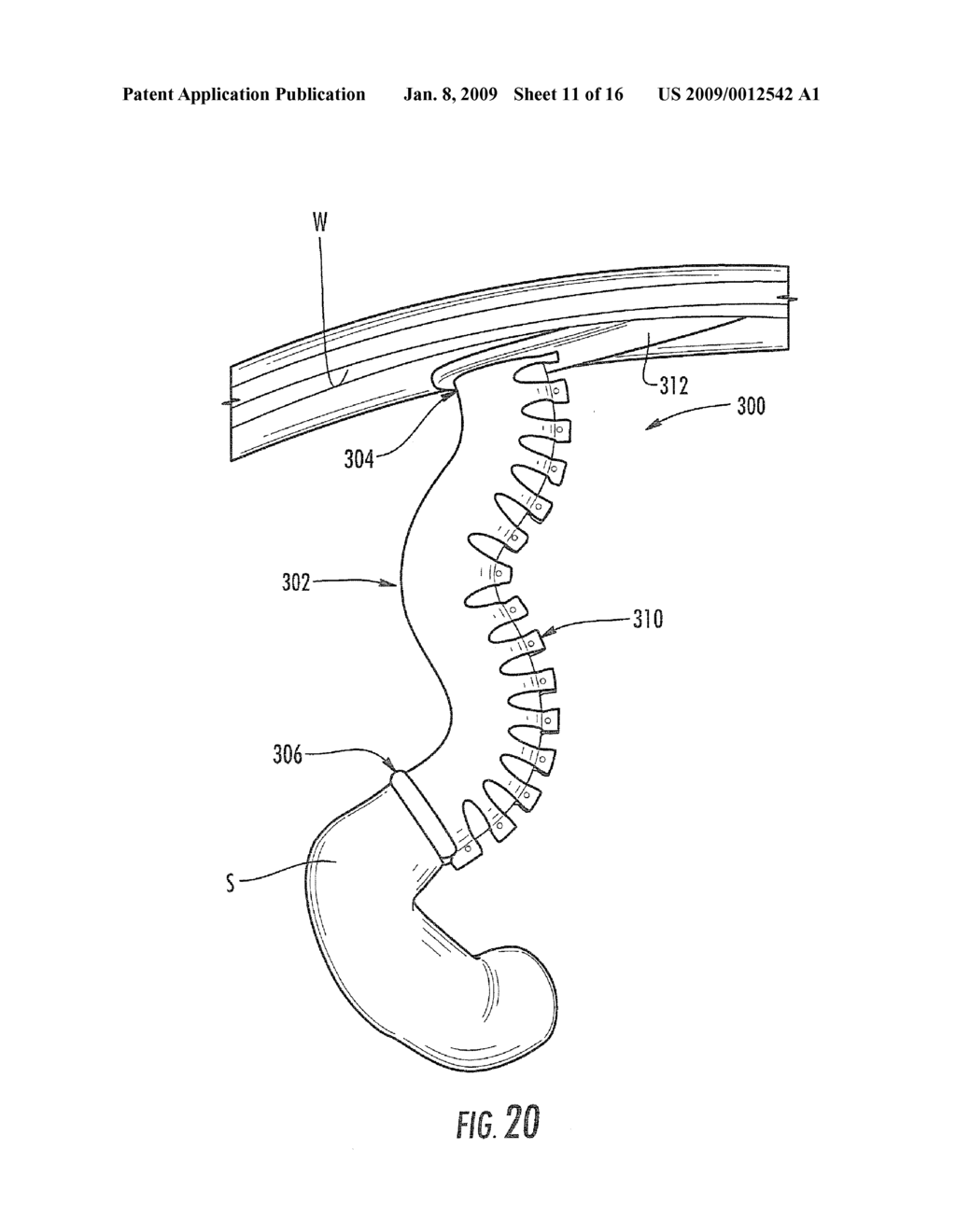 SATIATION DEVICES AND METHODS FOR CONTROLLING OBESITY - diagram, schematic, and image 12