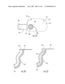 SATIATION DEVICES AND METHODS FOR CONTROLLING OBESITY diagram and image