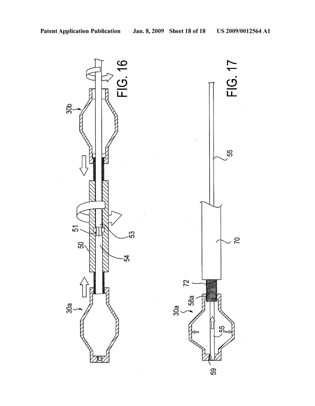 TRANSDISCAL INTERBODY FUSION DEVICE AND METHOD - diagram, schematic, and image 19