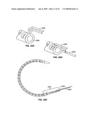 MINIMALLY INVASIVE LUNG VOLUME REDUCTION DEVICES, METHODS, AND SYSTEMS diagram and image