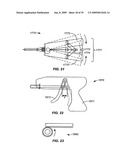 MINIMALLY INVASIVE LUNG VOLUME REDUCTION DEVICES, METHODS, AND SYSTEMS diagram and image