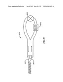 MINIMALLY INVASIVE LUNG VOLUME REDUCTION DEVICES, METHODS, AND SYSTEMS diagram and image