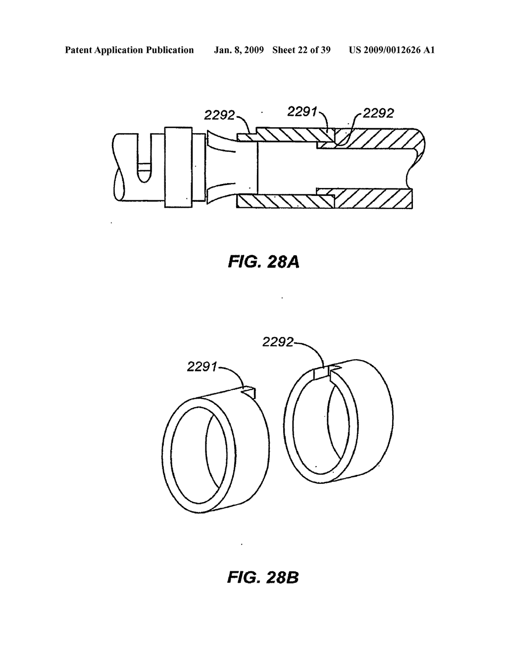 MINIMALLY INVASIVE LUNG VOLUME REDUCTION DEVICES, METHODS, AND SYSTEMS - diagram, schematic, and image 23