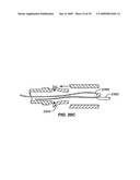 MINIMALLY INVASIVE LUNG VOLUME REDUCTION DEVICES, METHODS, AND SYSTEMS diagram and image