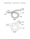 MINIMALLY INVASIVE LUNG VOLUME REDUCTION DEVICES, METHODS, AND SYSTEMS diagram and image