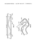 MINIMALLY INVASIVE LUNG VOLUME REDUCTION DEVICES, METHODS, AND SYSTEMS diagram and image