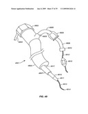 MINIMALLY INVASIVE LUNG VOLUME REDUCTION DEVICES, METHODS, AND SYSTEMS diagram and image