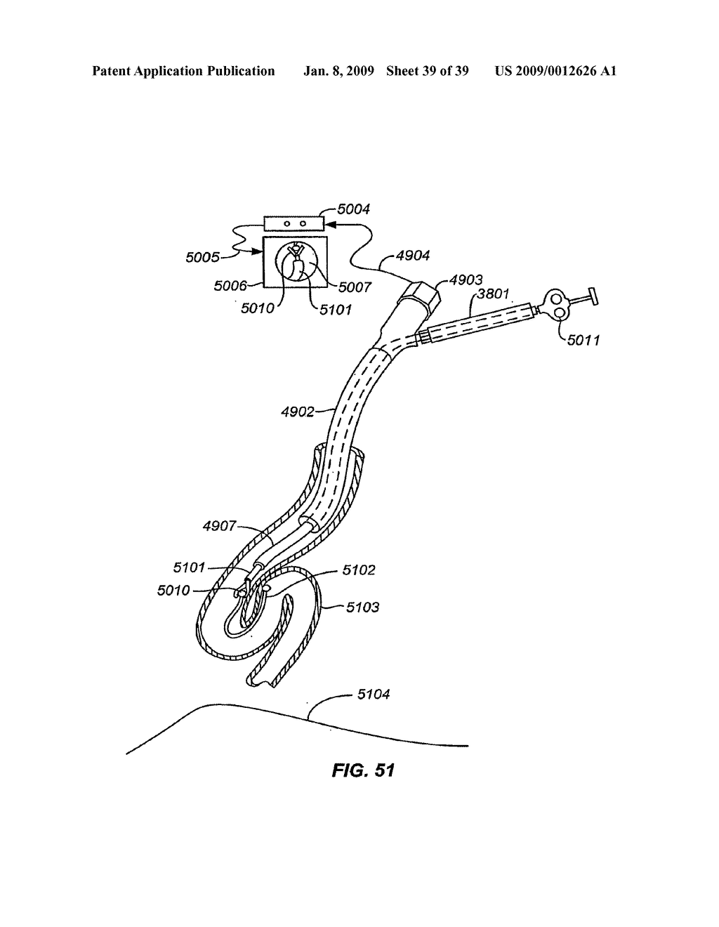 MINIMALLY INVASIVE LUNG VOLUME REDUCTION DEVICES, METHODS, AND SYSTEMS - diagram, schematic, and image 40