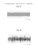 ROAD SURFACE CONDITION DETECTION SYSTEM, ACTIVE SUSPENSION SYSTEM, ANTI-LOCK BRAKE SYSTEM, AND SENSOR UNIT THEREFOR diagram and image